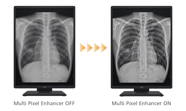 Multi Pixel Enhancer OFF → Multi Pixel Enhancer ON